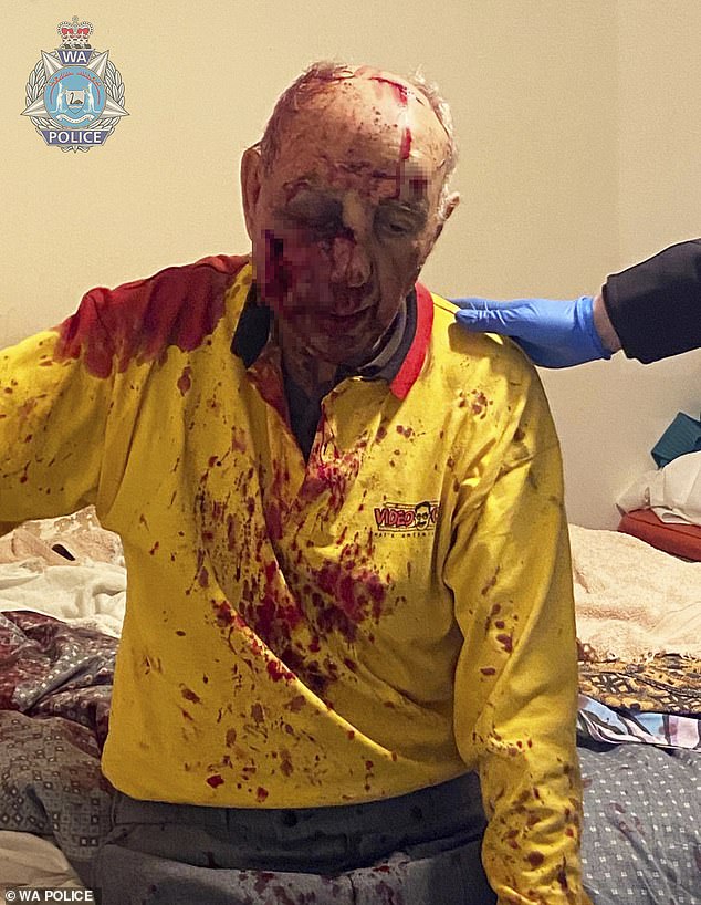 Emilio Lombardi, 84, was allegedly assaulted outside his home in Cannington in Perth on August 16, suffering gruesome injuries (pictured)