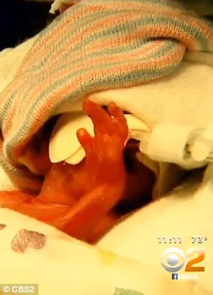 Baby hands: Decklen