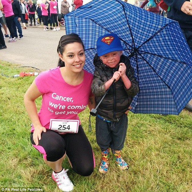 Despite his condition, Jayden learned to walk and talk and now attends nursery, where he has lots of friends. He is pictured with his mother during a charity run