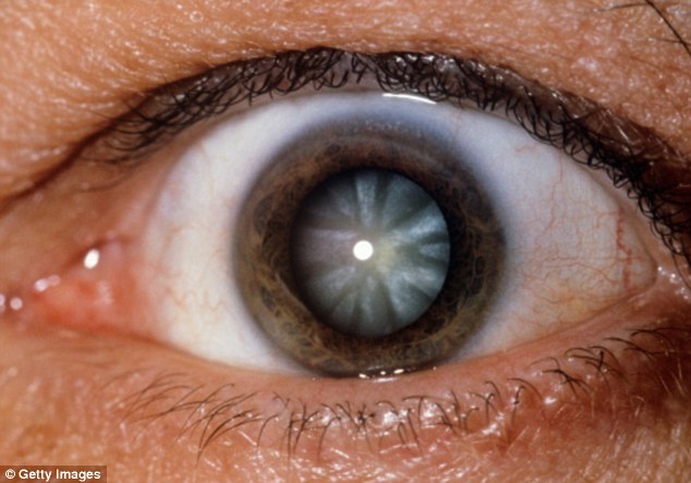 One thing that almost all scientists agree on is that microwave radiation causes cataracts