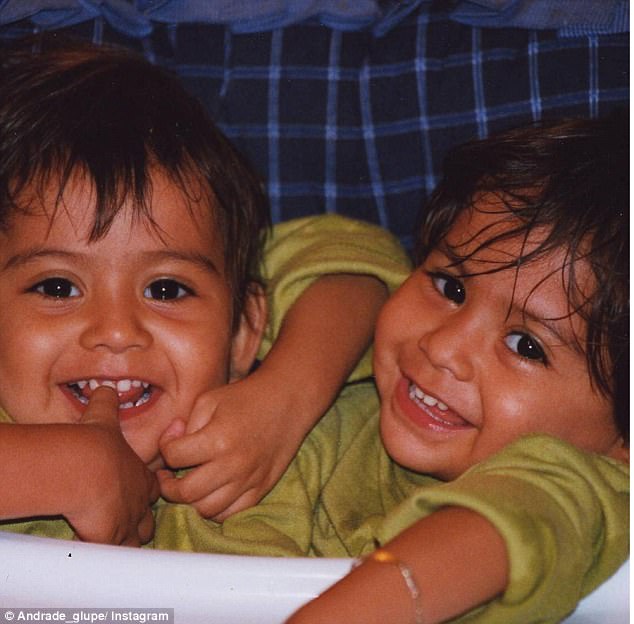 The girls were born in Veracruz, Mexico, and were only expected to live for three days. When they continued to thrive, their parents, Norma and Victor, considered separation but were told it was too risky because of how many organs they shared (Carmen, left, and Lupita, right, at age one)