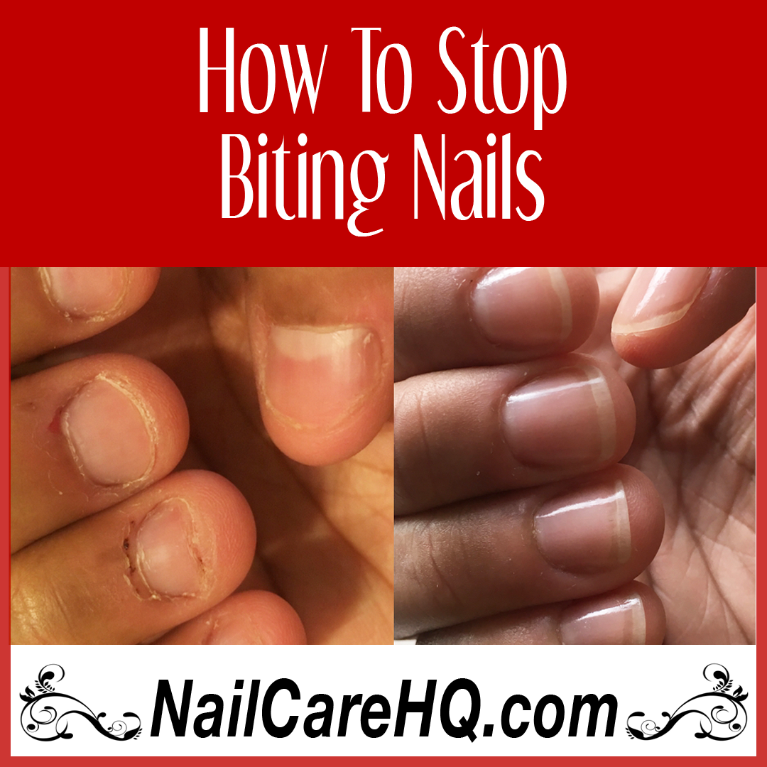 how to stop biting nails Angela